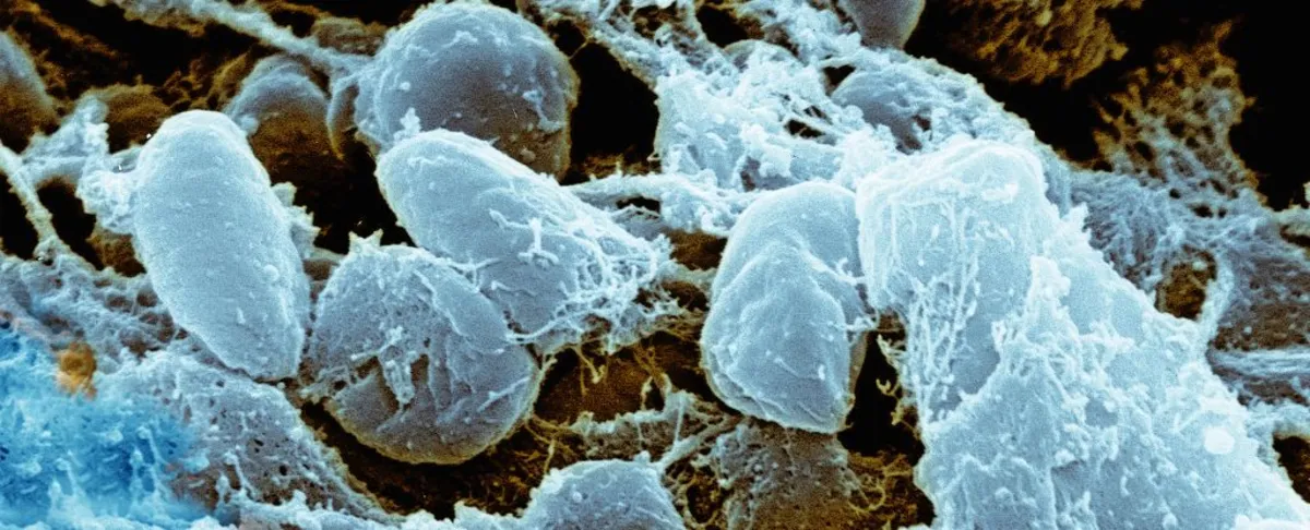 Arizona Plague Death: A Rare but Deadly Reminder of History