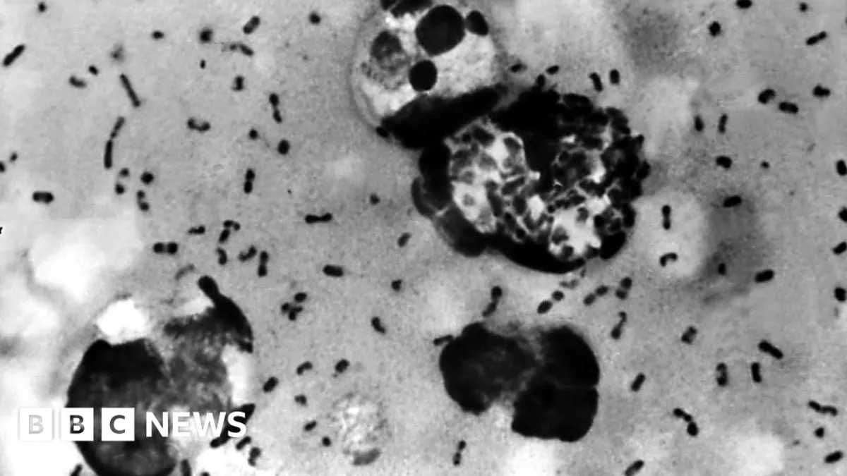 Arizona Resident Dies from Rare Pneumonic Plague: Health Officials Confirm