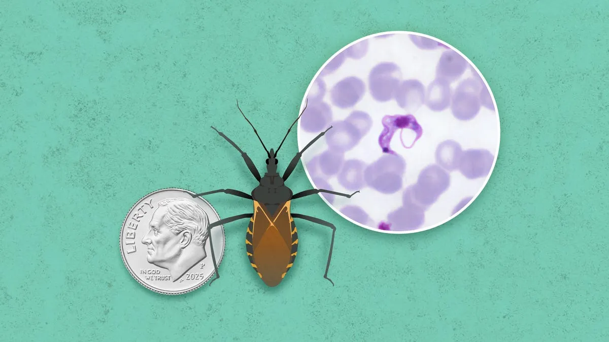 Beware the Kissing Bug: Chagas Disease on the Rise in the U.S.