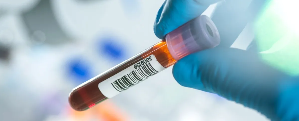 Breakthrough Blood Test for Alzheimer's Approved: A New Hope for Early Treatment