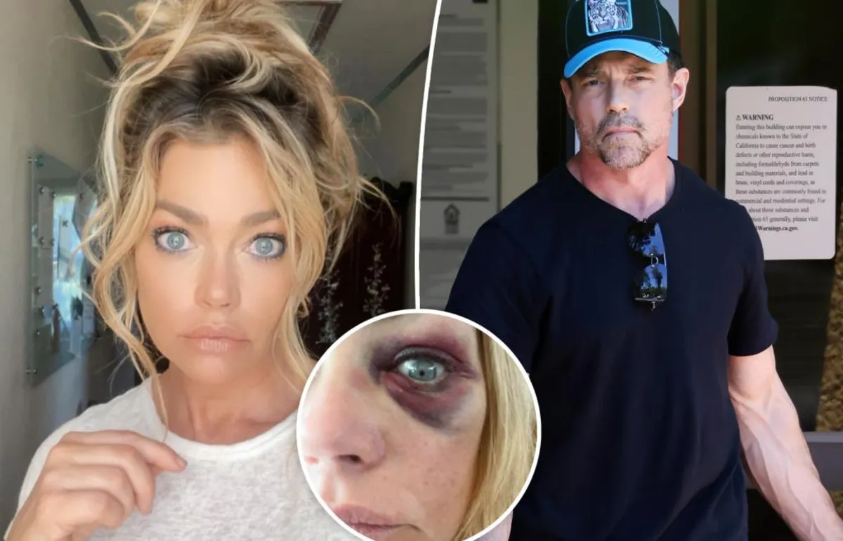 Denise Richards' Black Eye Controversy: New Allegations Against Aaron Phypers