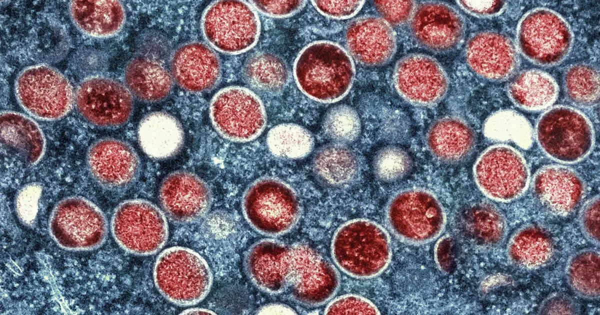 Emerging Threat: New Strain of Mpox Confirmed in Los Angeles County