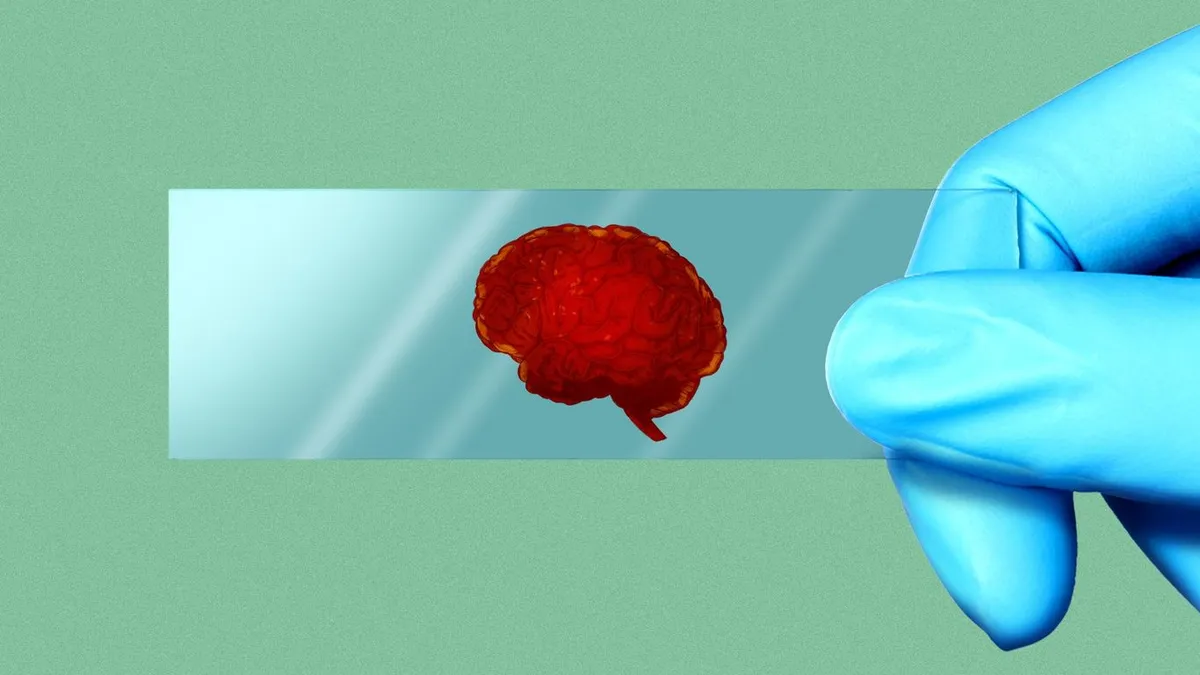 FDA Approves Groundbreaking Blood Test for Alzheimer's Diagnosis