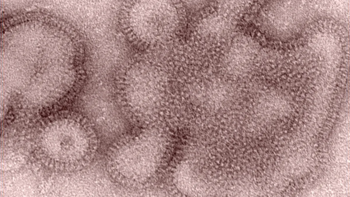 First Flu-Related Death of the Season Reported in North Carolina