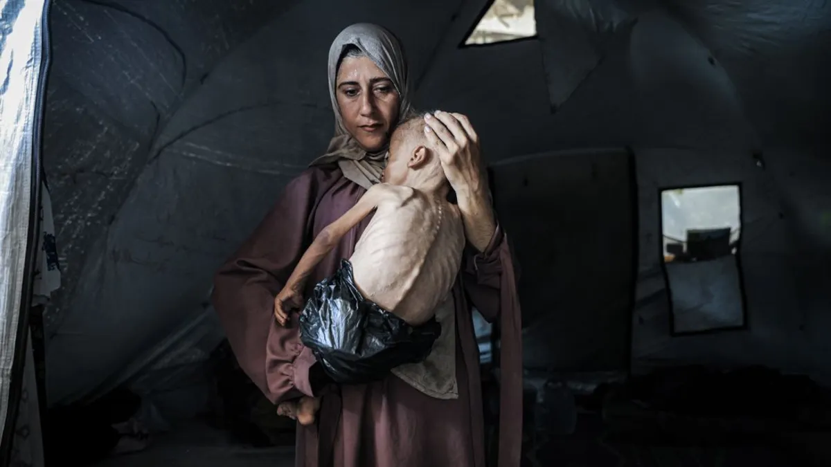 Gaza Crisis: The Harrowing Reality of Starvation