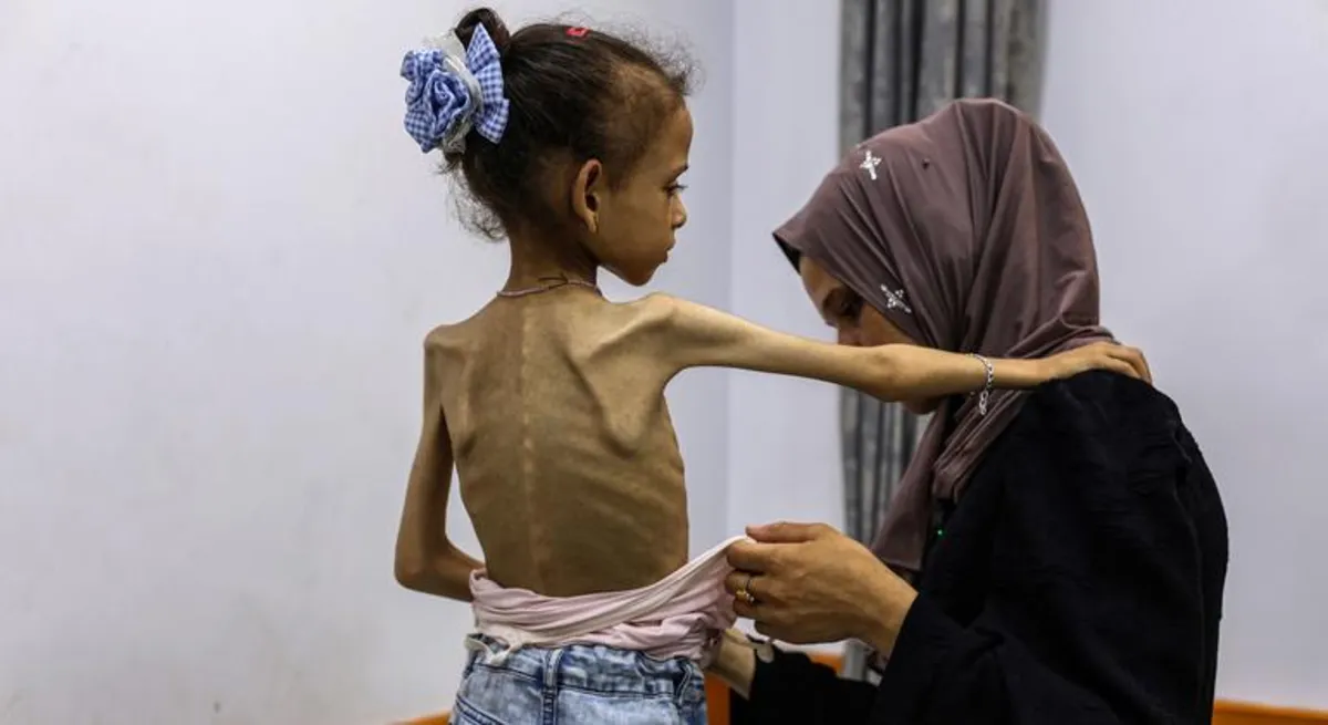 Gaza on the Brink: UN Warns of Imminent Famine Crisis
