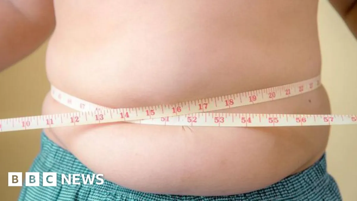 Global Obesity Crisis: More Children Obese Than Underweight for the First Time