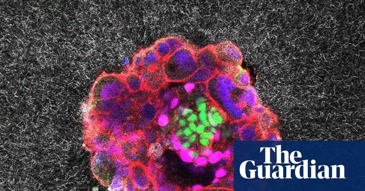 Groundbreaking 3D Footage Reveals Human Embryo Implantation Process
