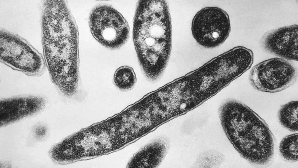 Legionnaires' Disease Outbreak Claims Fourth Life in New York City