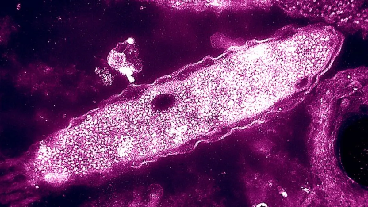 Legionnaires’ Disease Outbreak in Central Harlem: 99 Cases Reported