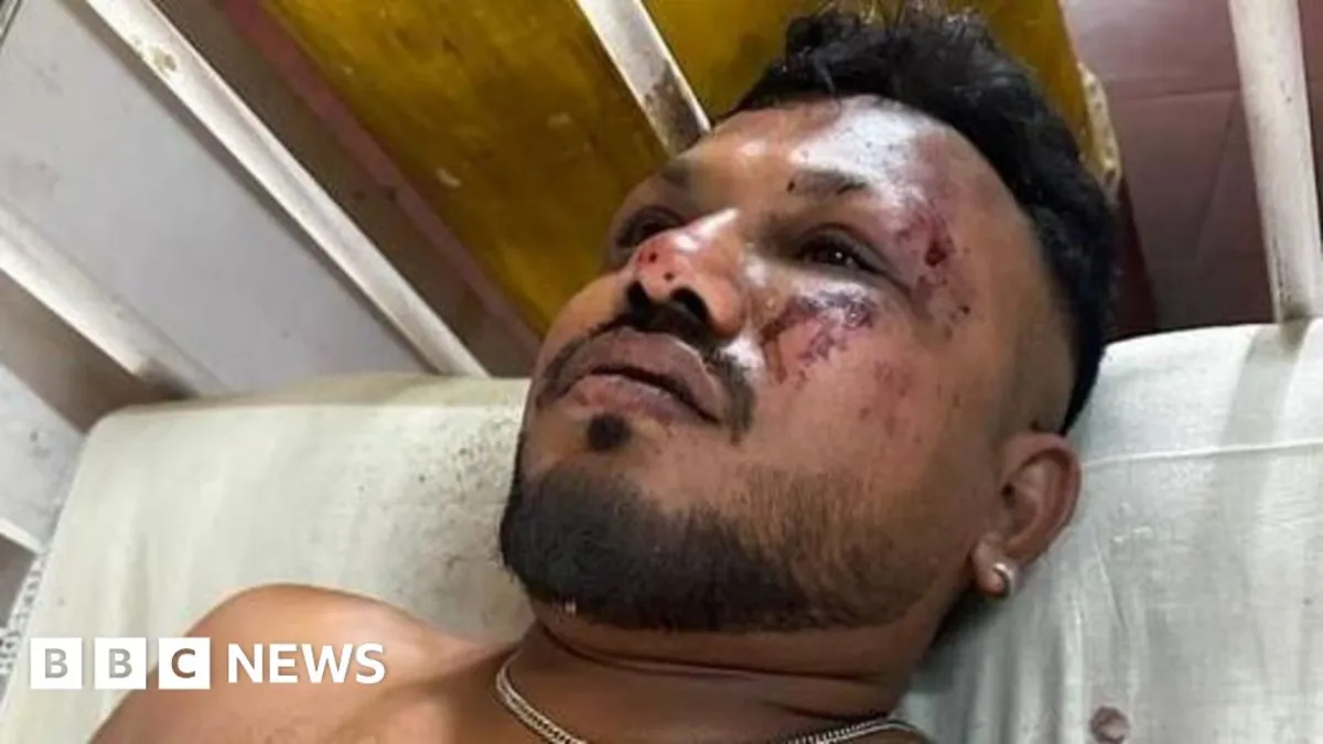 Miracle Survival: Man Escapes Air India Crash That Claimed 200 Lives