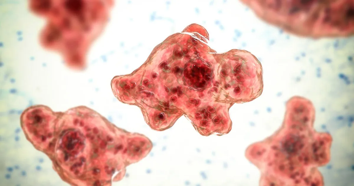Missouri Patient Hospitalized with Rare Brain-Eating Amoeba Infection
