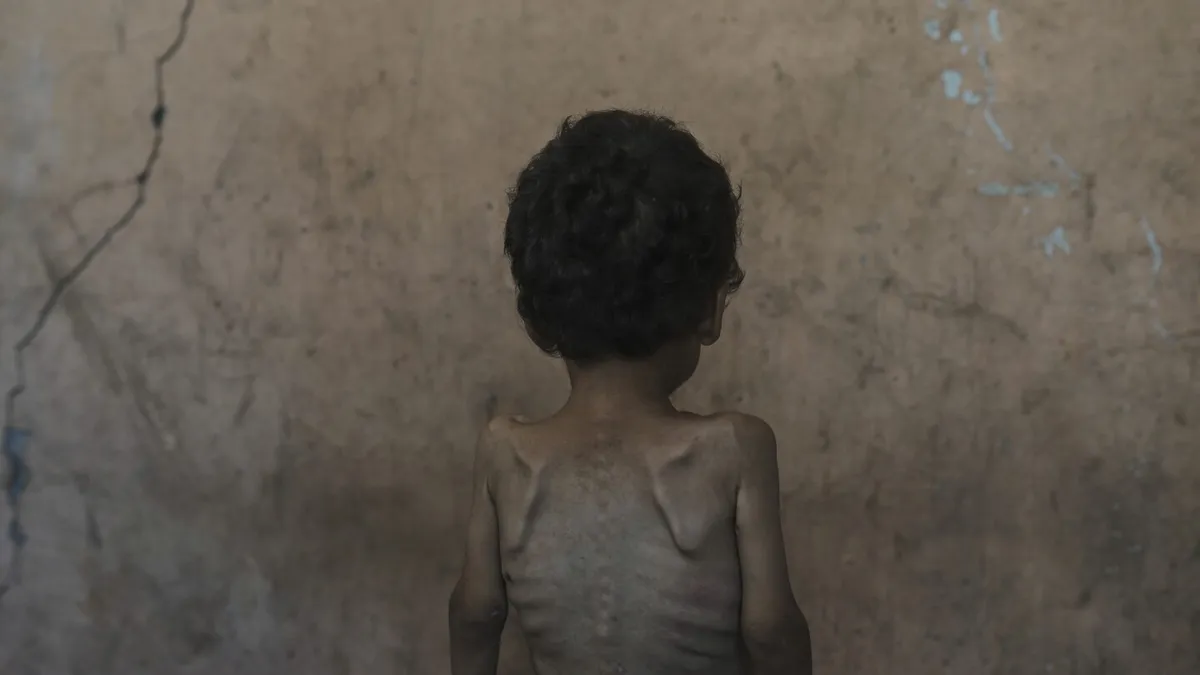 Netanyahu Claims No Starvation in Gaza Amid Growing Humanitarian Crisis