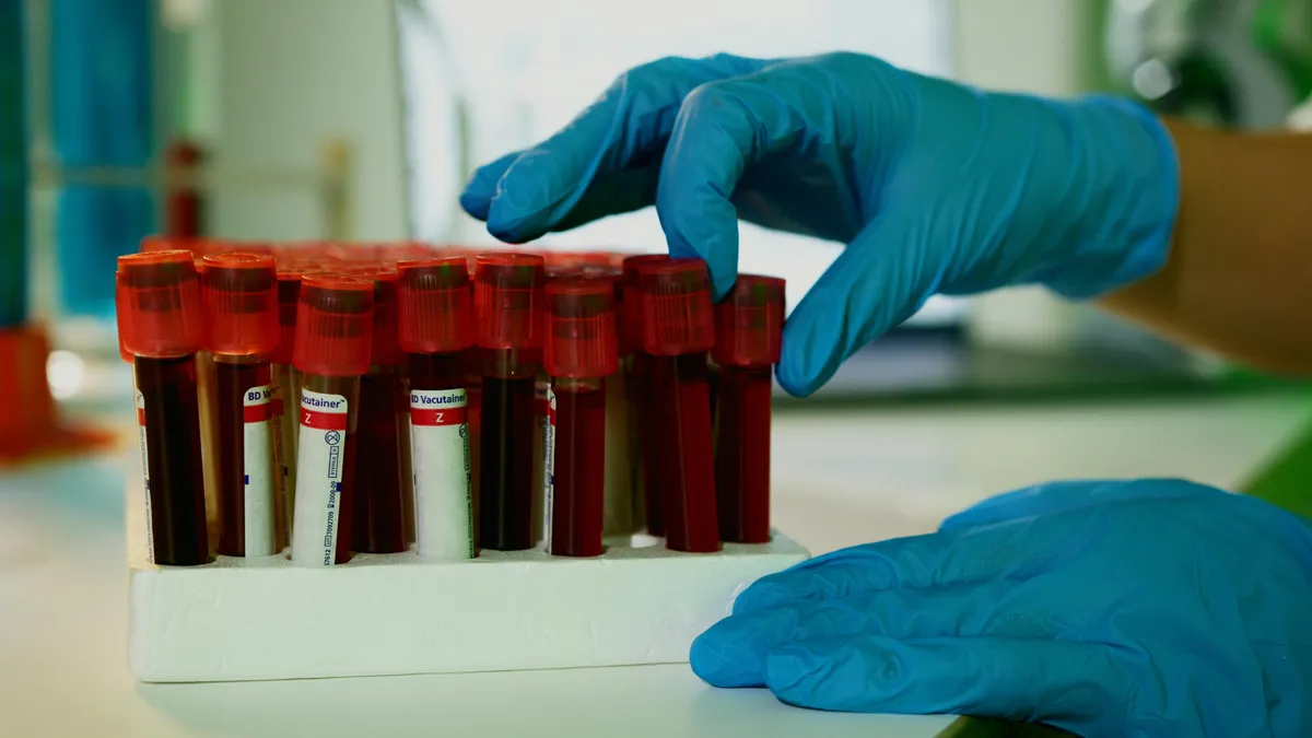 New Research Links Insulin Resistance to Rapid Cognitive Decline in Alzheimer's Patients