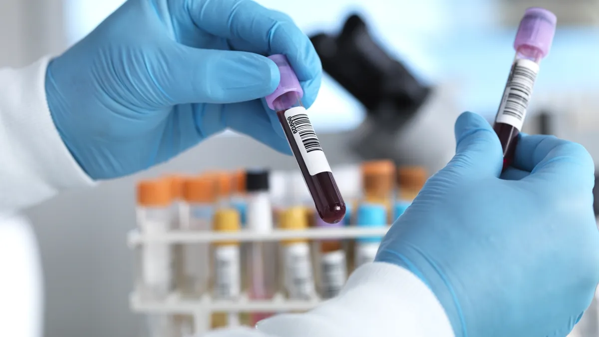 Older Americans Eager for Alzheimer's Blood Test: Survey Reveals Shifting Attitudes