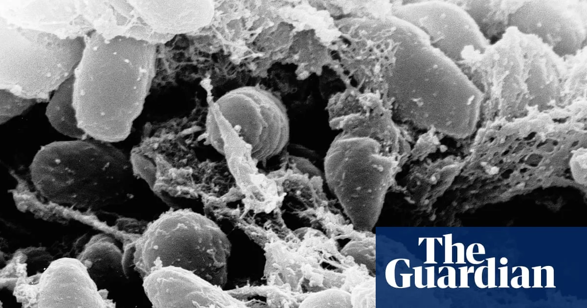 Plague Case Confirmed in South Lake Tahoe: What You Need to Know