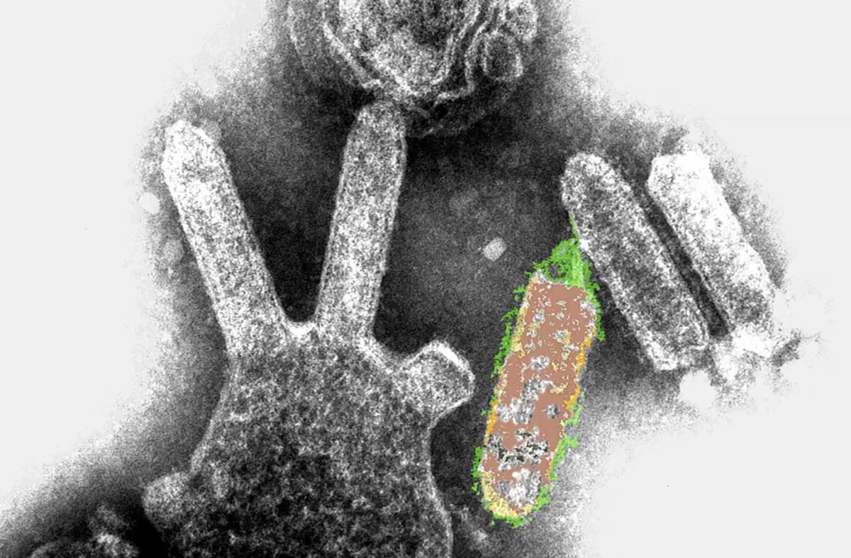 Rare Bat-Borne Virus Claims Life of Australian Man: What You Need to Know