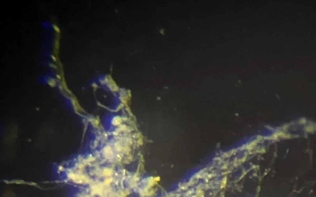 Revolutionary Bacterium Found: Meet Ca. Electrothrix yaqonensis, the Future of Bioelectronics