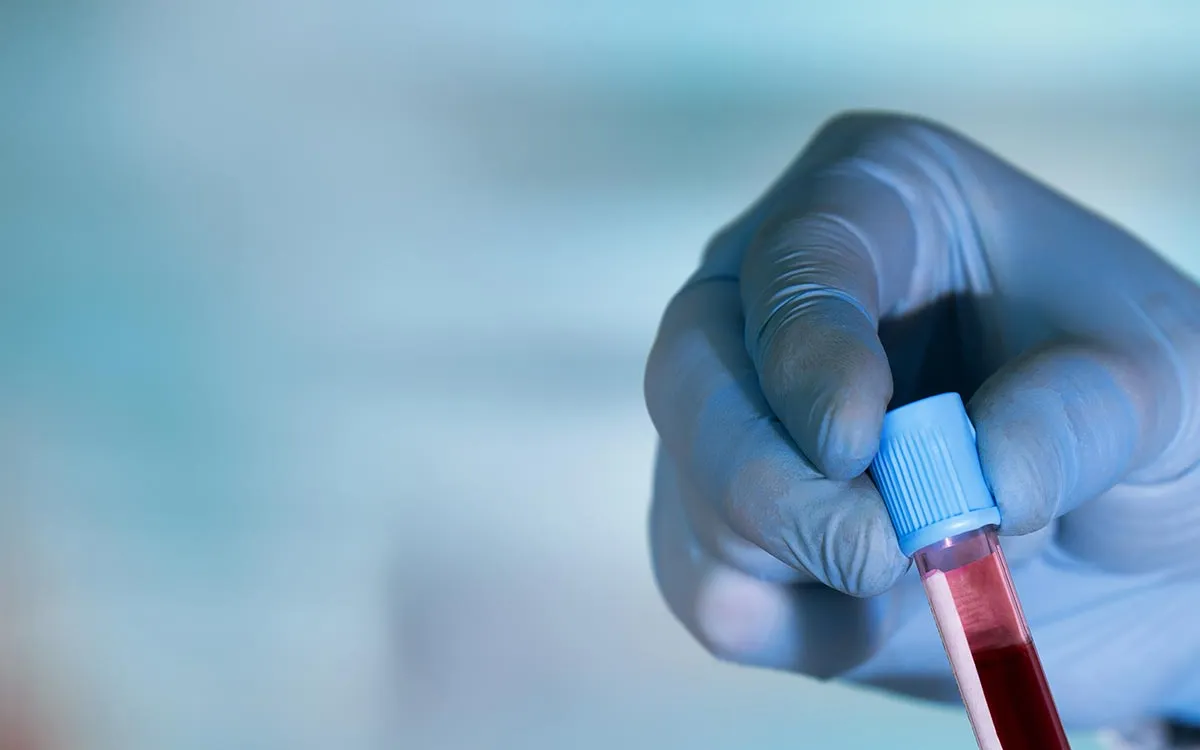 Revolutionary Blood Test Detects HPV-Related Cancers Years Before Symptoms Emerge
