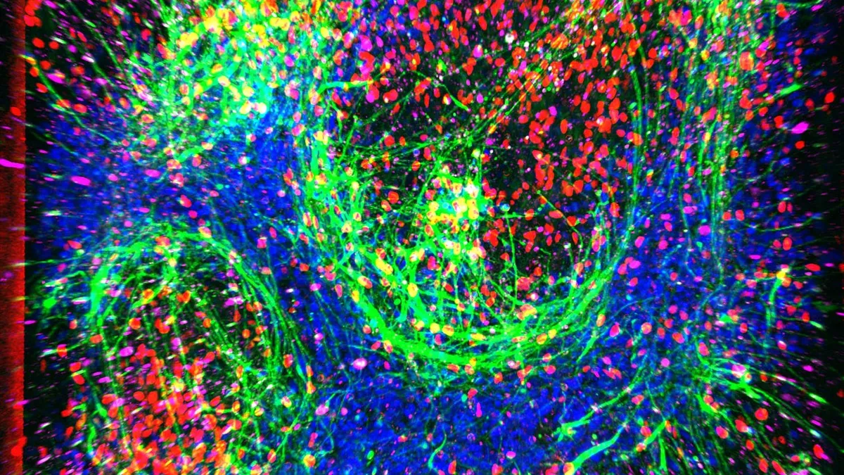 Revolutionary 'Disease-on-a-Chip' Model Offers New Hope for ALS Treatments