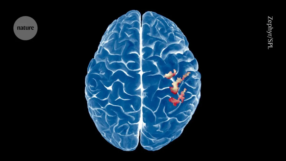Revolutionary Study Challenges Long-Held Beliefs About Brain Mapping After Amputation