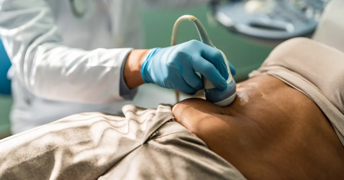 Rising Appendix Cancer Rates: A Growing Concern for Gen X and Millennials