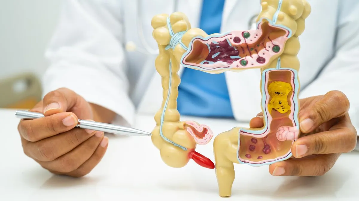 Rising Appendix Cancer Rates: What Younger Adults Must Know