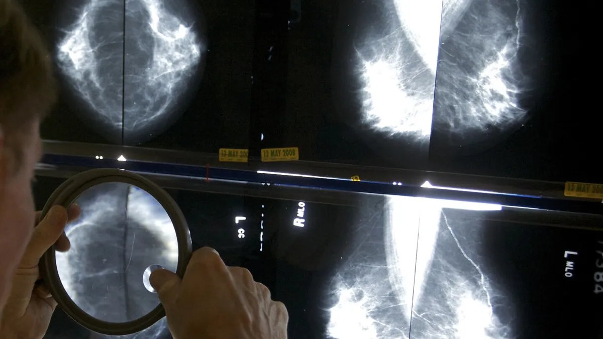 Surge in Early-Onset Cancers: What's Behind the Alarming Trend?