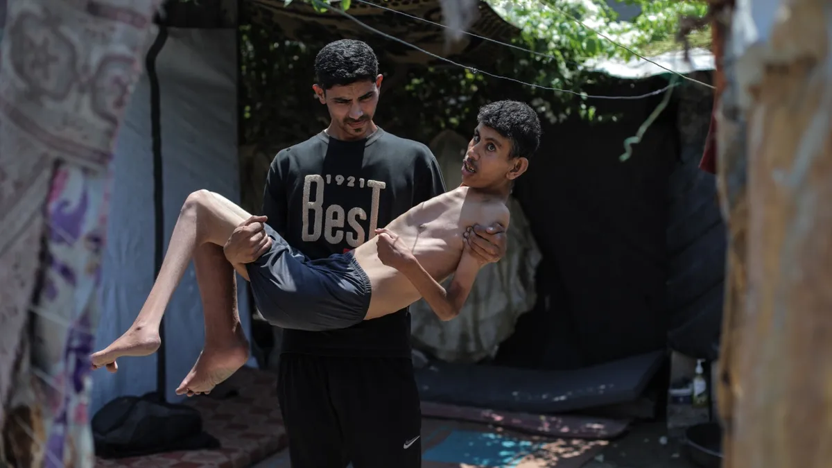 The Silent Suffering: Starvation's Grasp on Gaza's Children