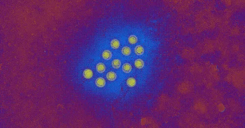 Hepatitis A Outbreak Declared in Los Angeles County: What You Need to Know