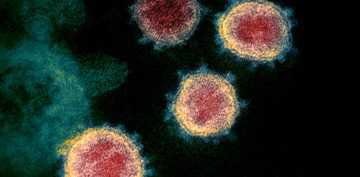 Unlocking the Mystery of Long-COVID and ME/CFS: The Role of 'Zombie' Cells