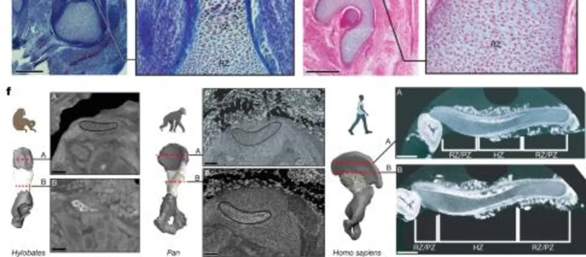 Unraveling the Evolution of Human Ilium Development: Insights from Endochondral Ossification