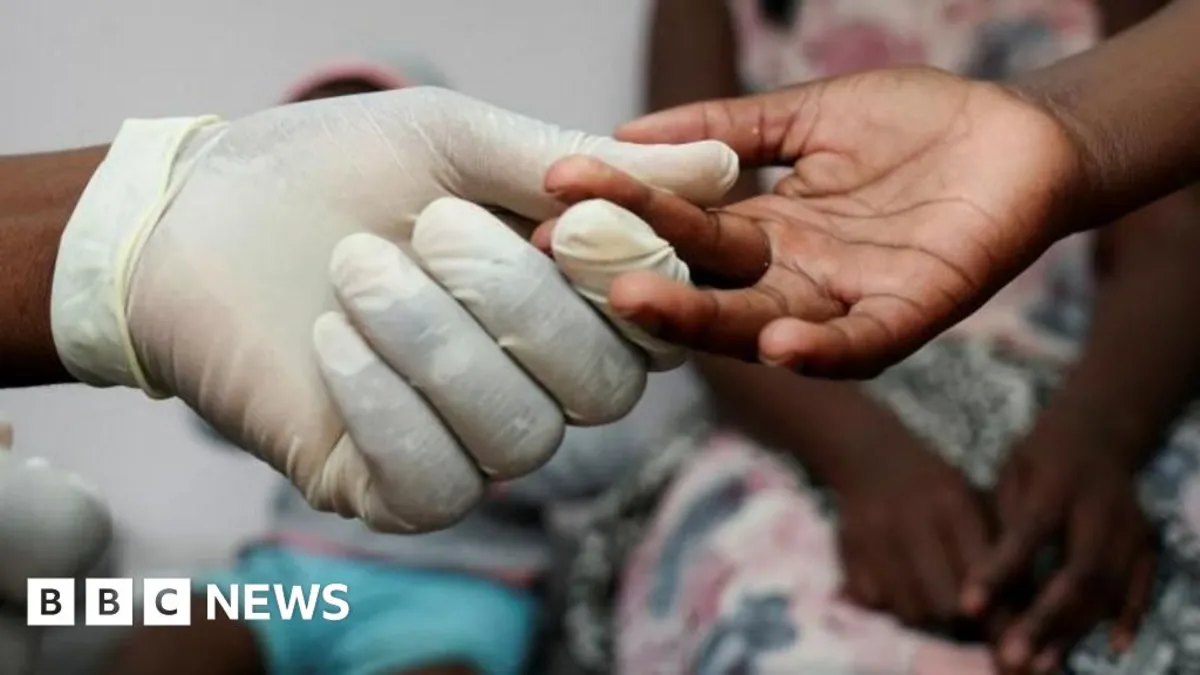 US Funding Cuts Threaten Progress in HIV/AIDS Treatment in South Africa